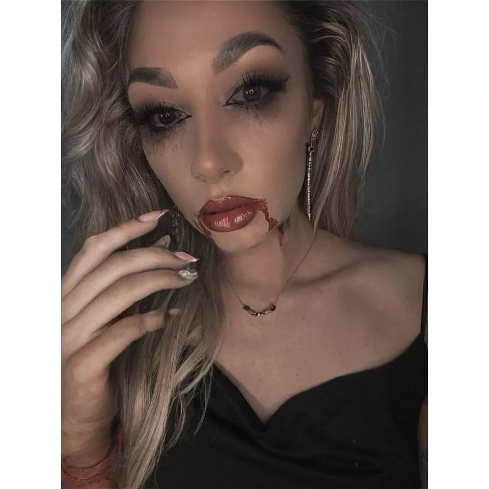 Małgorzata Główka z zespołu Camasutra cała we krwi?! Gwiazda disco polo nie do poznania! 